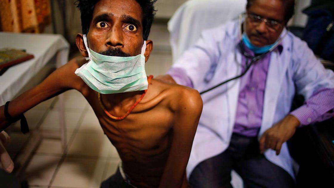 kesehatan.  Jumlah kematian akibat tuberkulosis di seluruh dunia telah meningkat sebesar 14 persen.
