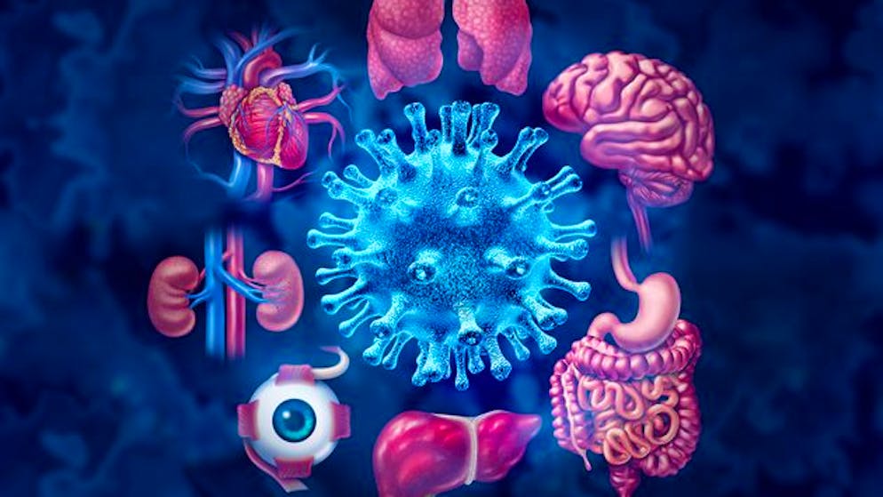 Eine Covid-19-Infektion kann auch nach Monaten noch eine Auswirkung auf Lunge, Herz, Nieren, Augen, Darm, Leber und Gehirn (von oben im Gegenuhrzeigersinn) haben.