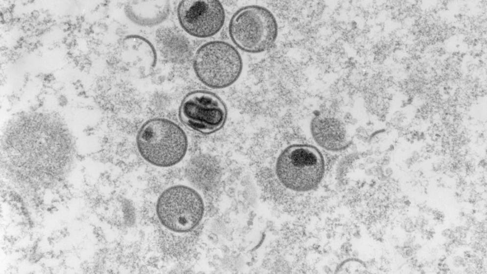 Für das Affenpocken-Virus wurde noch keinen neuen Namen gefunden, die Krankheit heisst laut WHO neuerdings Mpox. (Archivbild)