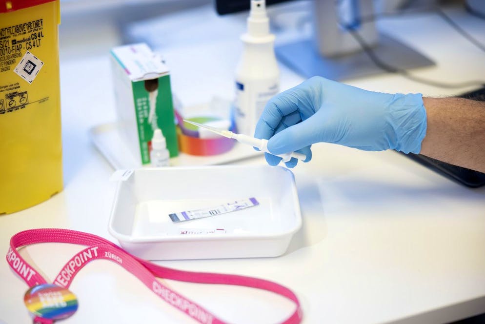 Un test rapido per l'HIV (immagine illustrativa/foto d'archivio).