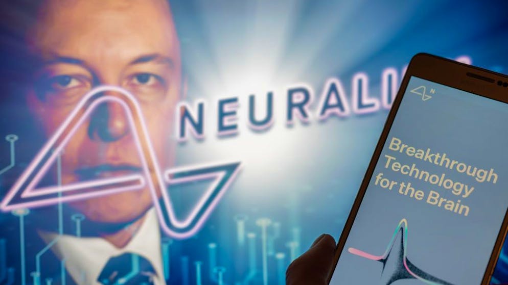 Gehirnchip-Entwicklung. Elon-Musk-Start-up soll Tiere quälen