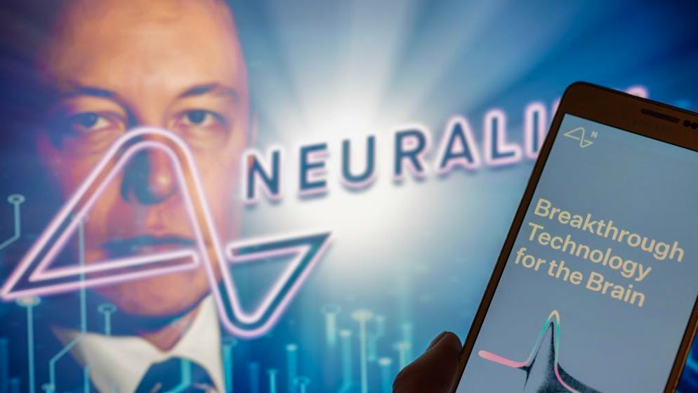 Neuralink ist eines der vielen Unternehmen von Tech-Mogul Elon Musk.