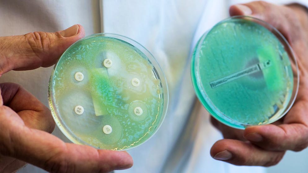 ARCHIV - Petrischalen mit sogenannten Krankenhauskeimen, die Mehrfachresistenzen gegenüber Antibiotika aufweisen. Foto: Armin Weigel/dpa