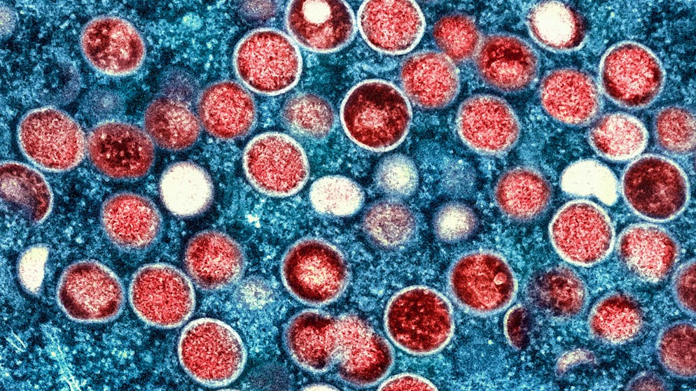 Eine eingefärbte Mikroskopaufnahme von mpox-Partikeln (rot) in einer infizierten Zelle (blau), die im Labor kultiviert wurde.