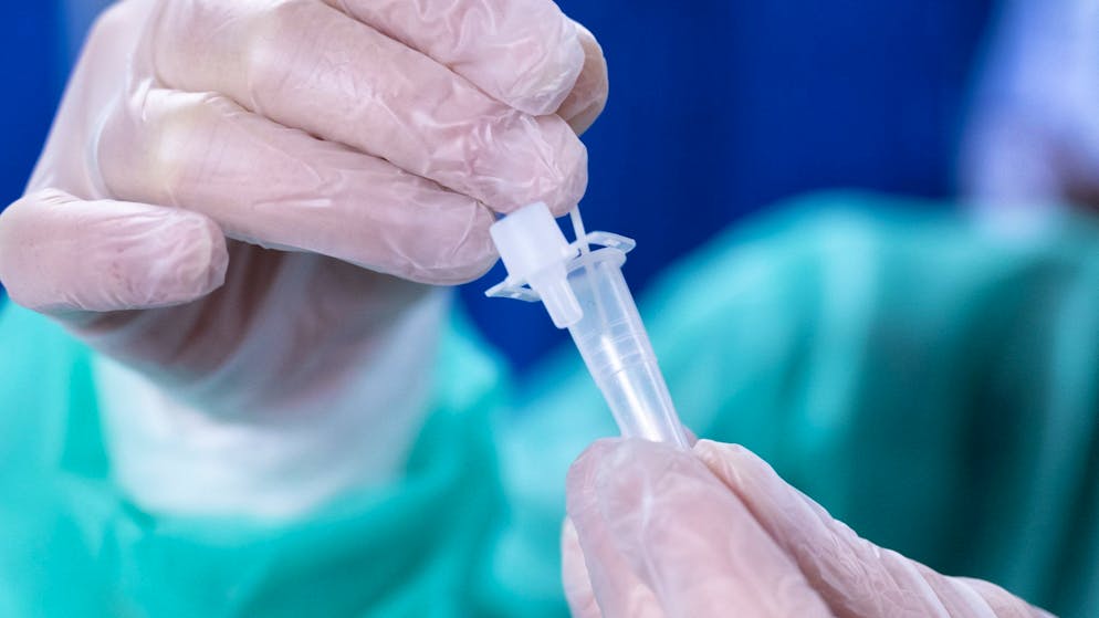 Staatsanwaltschaft Zürich ermittelt. Arzt soll mit erfundenen Corona-Tests Millionen erschlichen haben