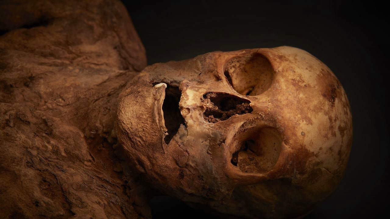 Archäologie. Bislang unbekanntes Bakterium an Basler Mumie entdeckt