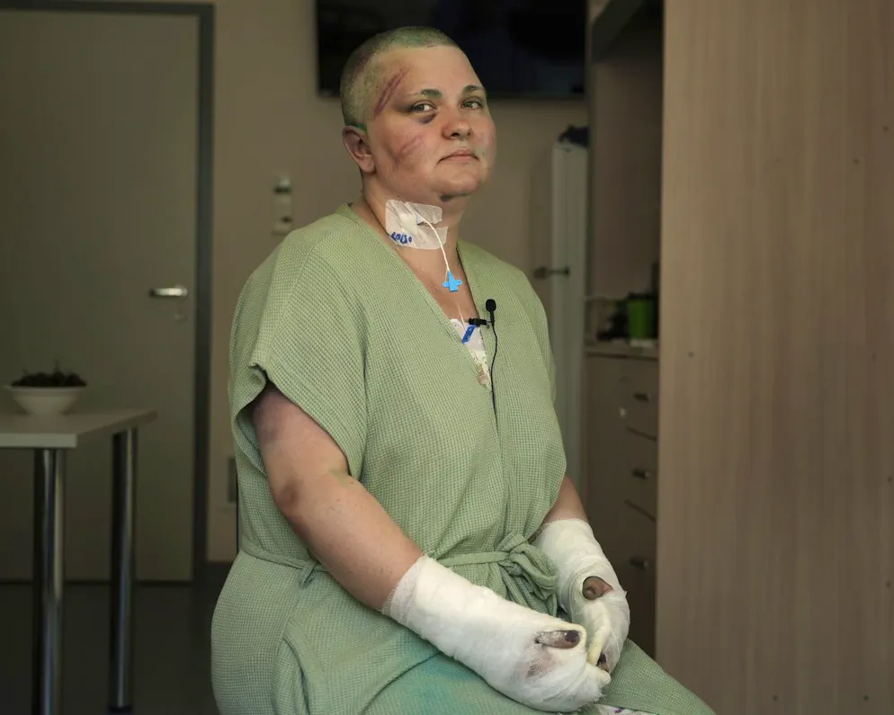 Die Investigativreporterin Jelena Milaschina  Gazeta am Mittwoch nach der ärztlichen Behandlung in Moskau.