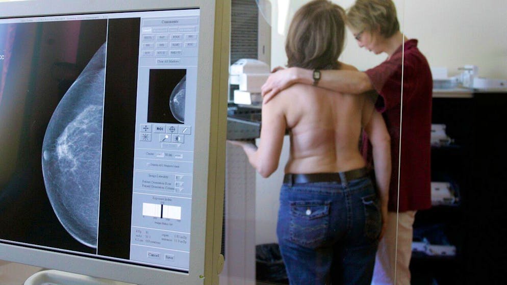 Alle Aargauerinnen von 50 bis 69 Jahren sollen künftig kostenlose Vorsorgeuntersuchungen zur Früherkennung von Brustkrebs erhalten. (Archivbild)