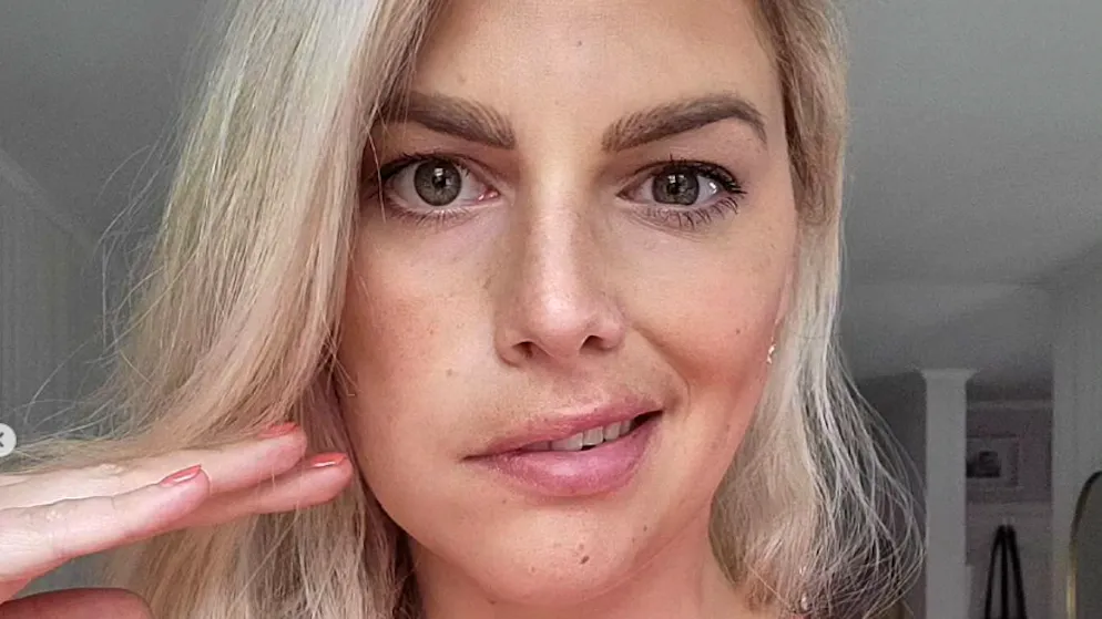 Gesicht plötzlich halbseitig gelähmt. So geht es Model Angelina Kirsch heute