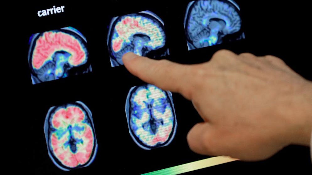 Genève accueillera une conférence sur les "dementia Brain Health Services" (dBHS), une approche révolutionnaire axée sur la prévention de la démence (photo d'illustration)