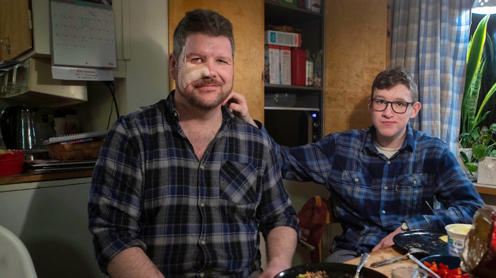 «Ultimative Rache». Mann erlegt und isst Bärin, die ihn ins Gesicht gebissen hat