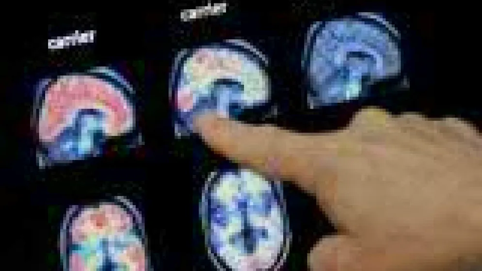 Le laboratoire vaudois AC Immune est spécialisé dans les maladies neurodégénératives (photo symbolique).