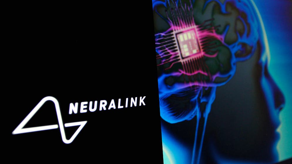 Der erste Mensch hat die Einpflanzung des Neuralink-Gehirnchips gut überstanden.