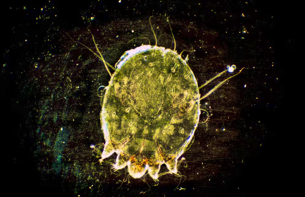 Un acarien de la gale sous le microscope : une maladie a de graves conséquences.