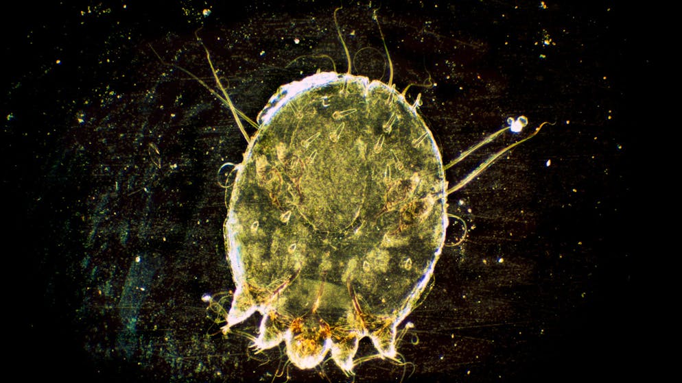 Monatelange Isolation und Schutzanzüge. Winterthurer Kleinkind hat Krätze – dann beginnt der Familien-Albtraum