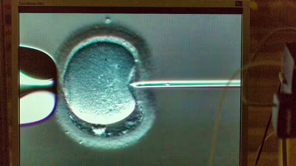 Un spermatozoïde est déposé dans l'ovule au moyen d'une micropipette.