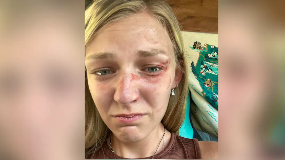 Gabby Petito ha scattato questo selfie poco prima che lei e il suo fidanzato fossero fermati dalla polizia per violenza domestica. Pochi giorni dopo, Petito era morta.
