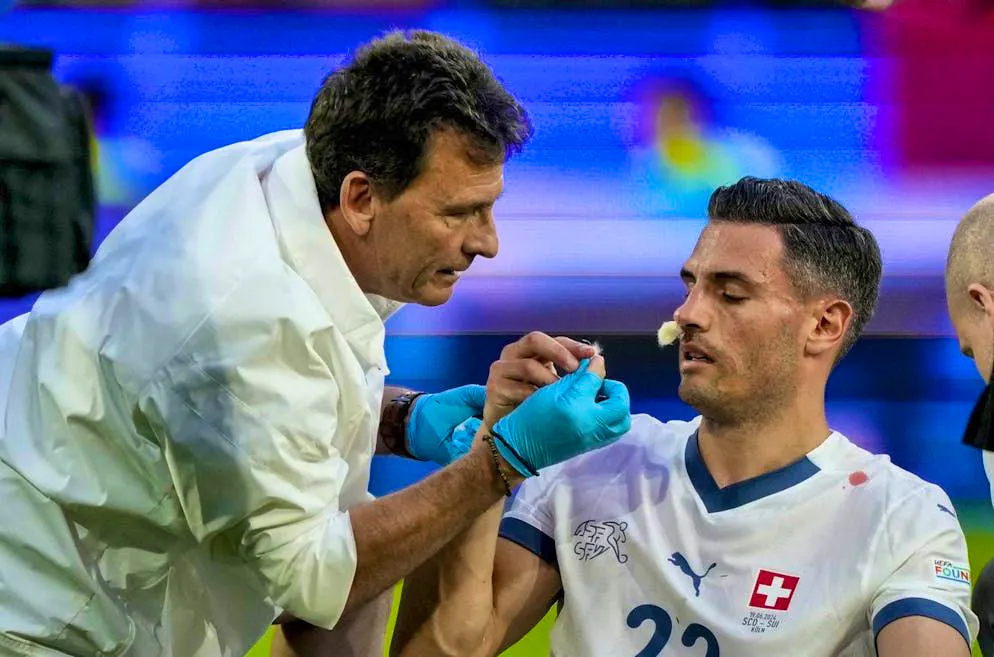 Nati star bites his teeth. Fabian Schär - Broken nose and finished playing