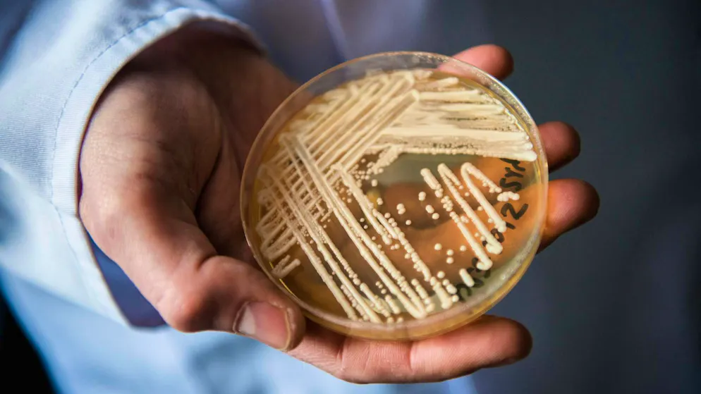 A petri dish with the yeast Candida auris. A new fungus has now been discovered in China.
