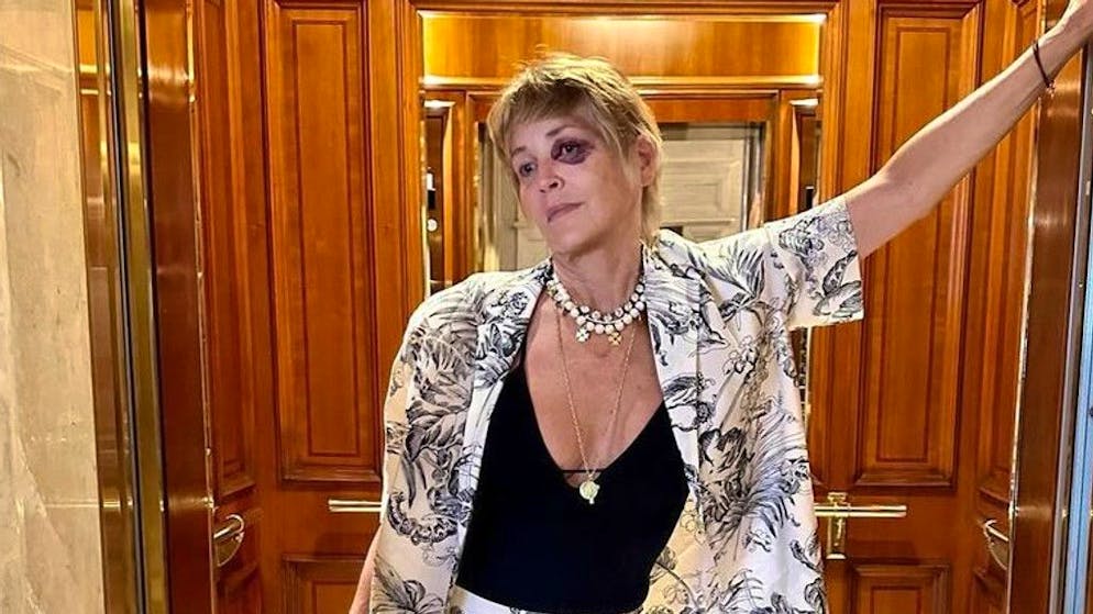 «Io sono più dura». Sharon Stone con un occhio nero: cosa è successo all'attrice?