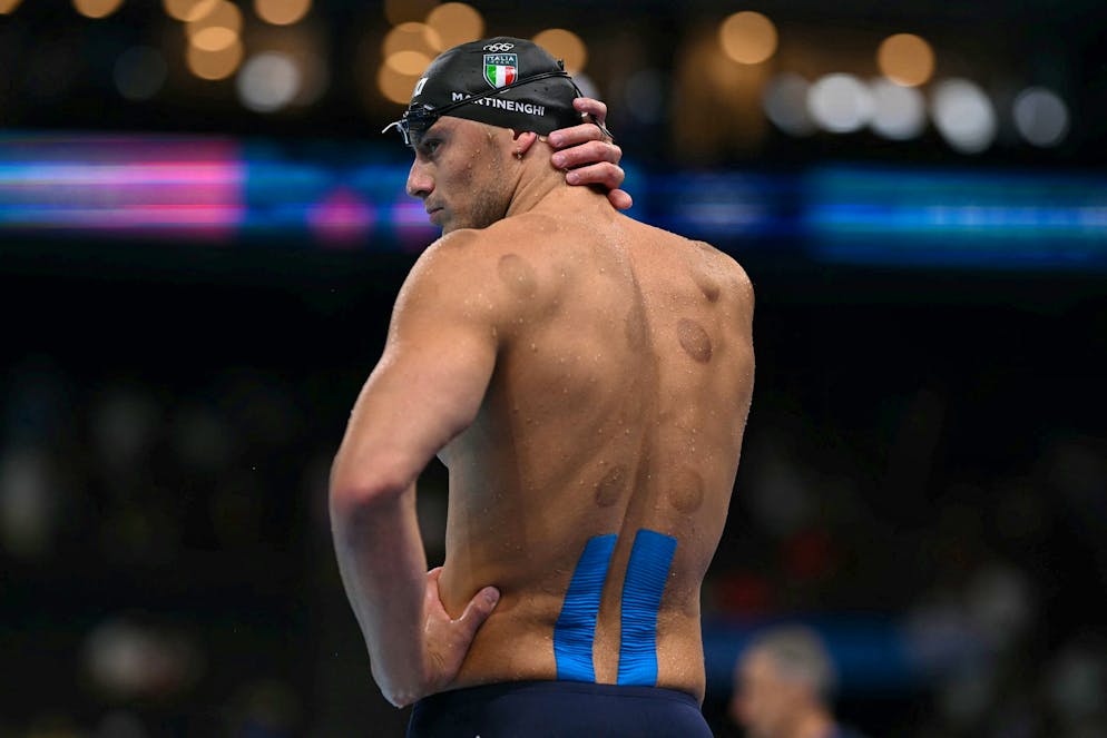 On peut observer des marques de ventouses de physiothérapie sur le dos du nageur italien Nicolo Martinenghi.