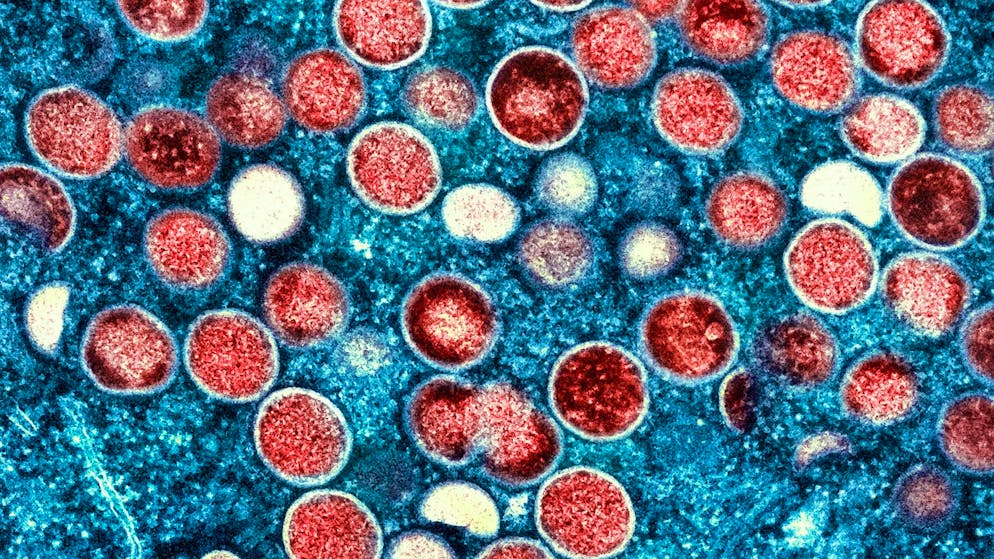 The Mpox virus is spreading in Africa. (archive picture)