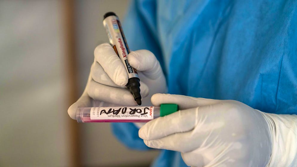 Mpox, «non c'è nessuna emergenza in Europa».