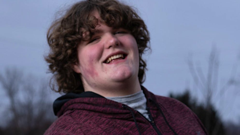 New world record. US teenager has the biggest hands and feet