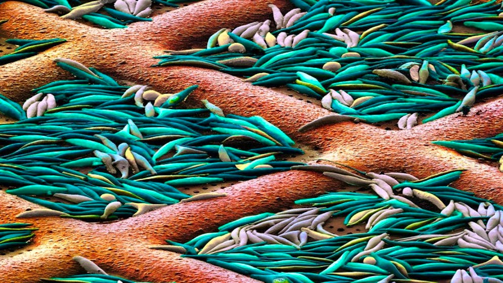 Diatoms frozen on a copper grid.