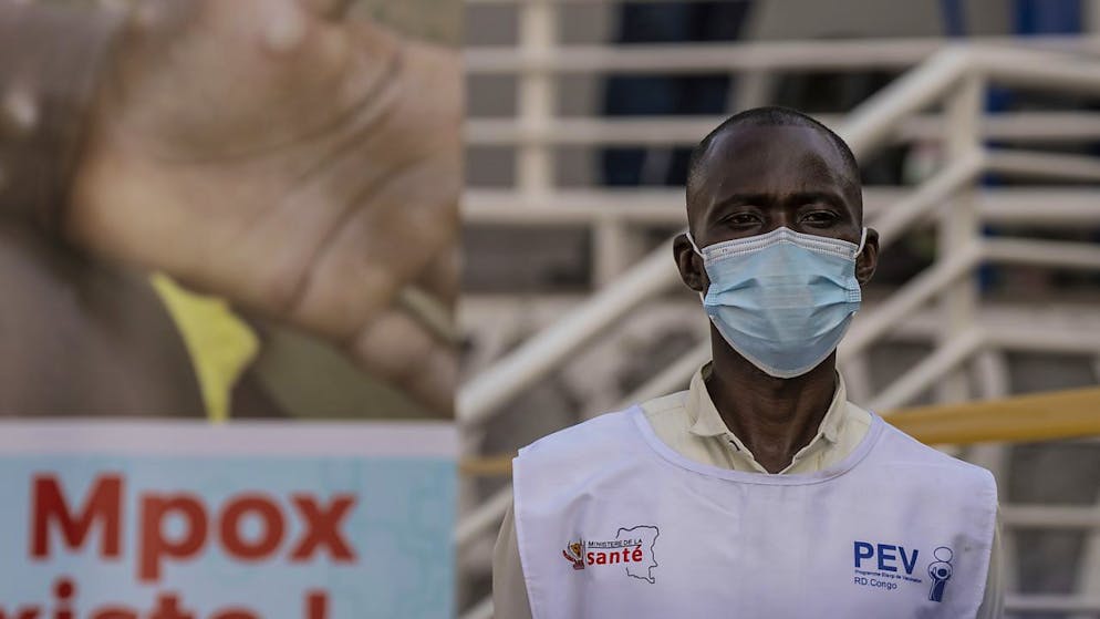 Die Gesundheitsbehörde der Afrikanischen Union (CDC) warnt vor der Ausbreitung des Mpox-Virus. (Archivbild)