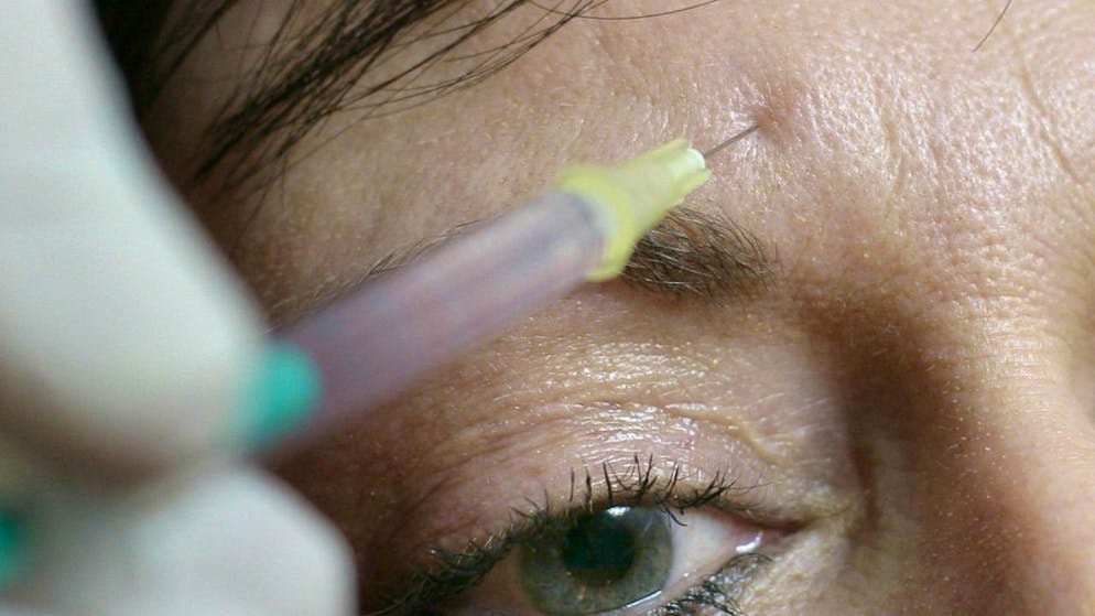 Nicht zuletzt dank der "injizierbaren Kosmetik", also den zahlreichen Botox-Produkten, hat Galderma in neun Monaten mehr Umsatz geschrieben. (Archivbild)