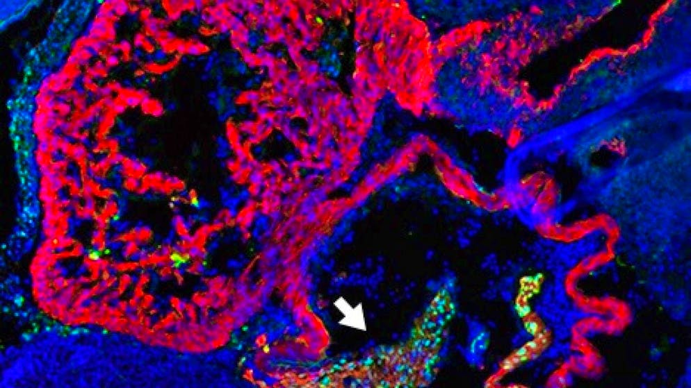 Section of a tissue slice through the heart of a mouse embryo.