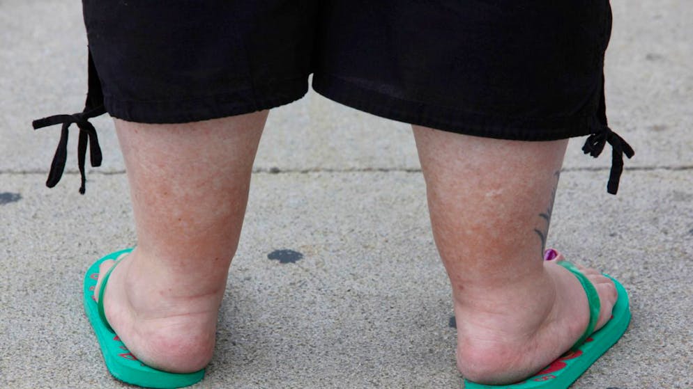 La vittima è un'infermiera 58enne che aveva accettato di partecipare a un trial sperimentale. (foto simbolica)