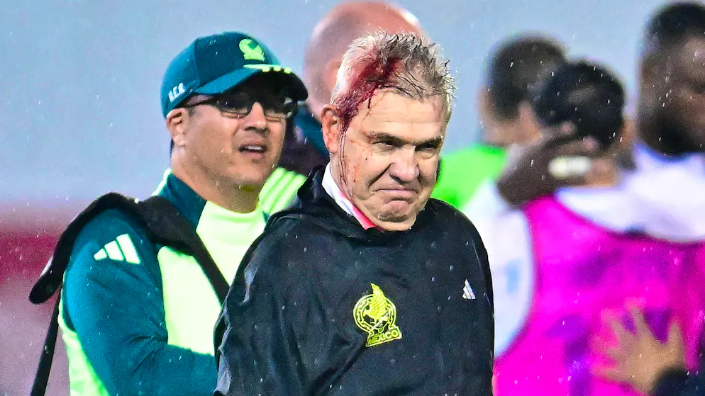 Mexico coach Javier Aguirre injured by projectile.