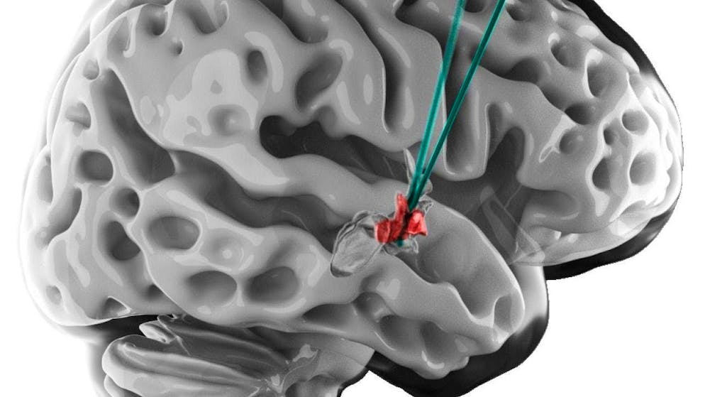 Scientists from Lausanne have discovered a brain region that is involved in walking.