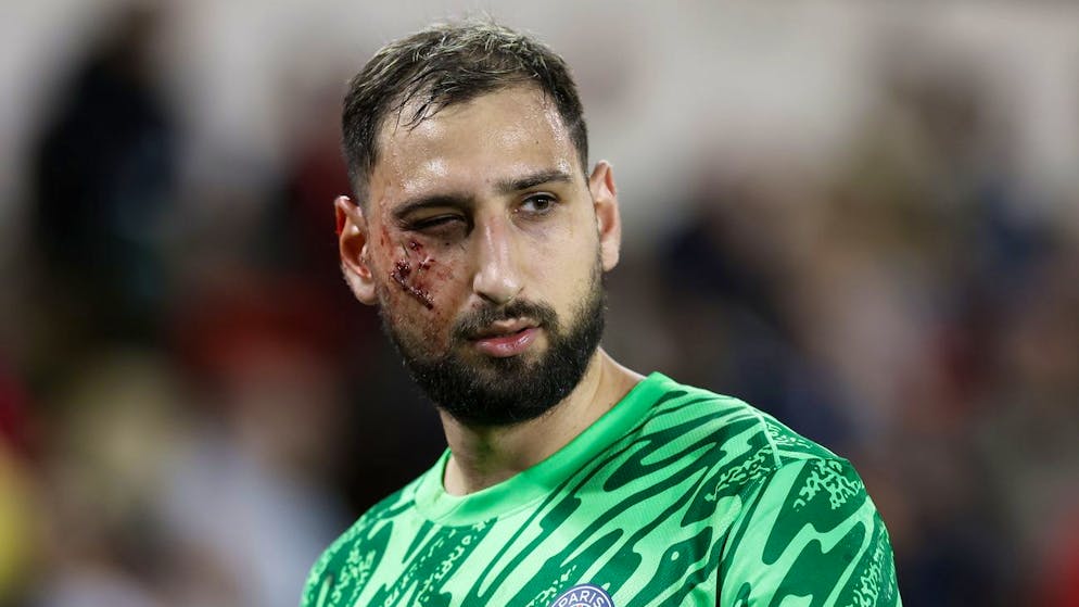 Malträtierter PSG-Keeper Gianluigi Donnarumma.
