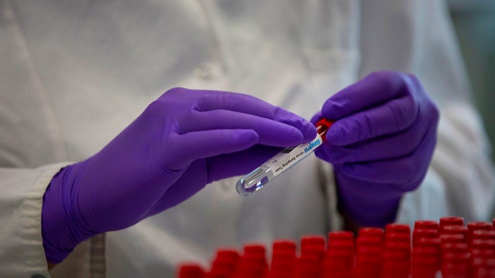 Der US-Pharma- und Medizintechnikkonzern Johnson & Johnson ist seit über 60 Jahren in der Schweiz vertreten und hat derzeit neun Standorte. (Archivbild)