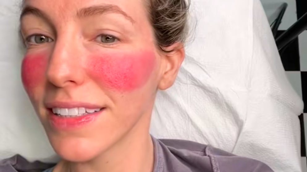 Zweifelhafter Trend. Mit einem Rouge-Tattoo hast du immer rote Bäckchen