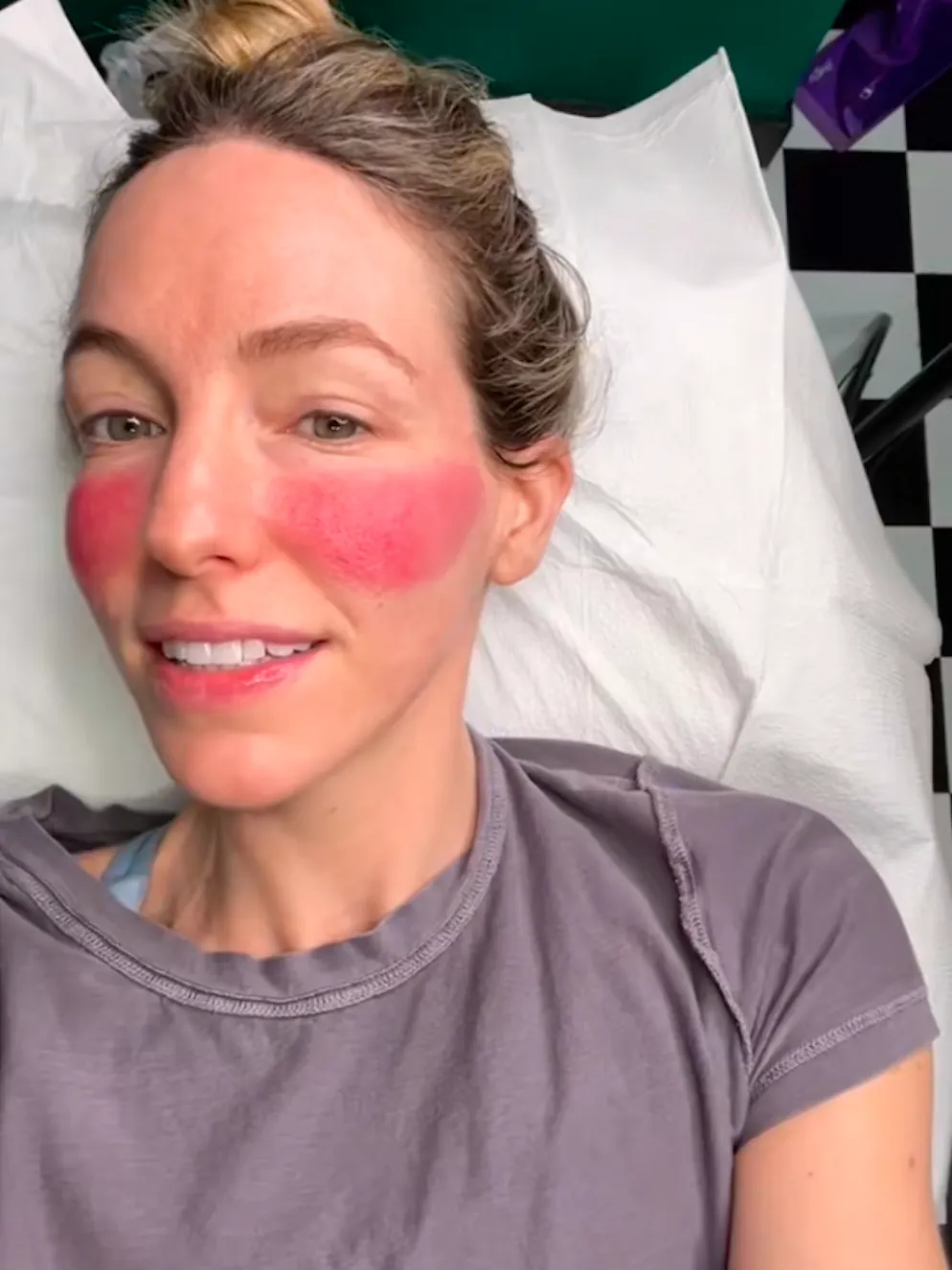 Grace Clarke teilt in TikTok-Videos ihre Erfahrung mit Rouge-Tattoos.