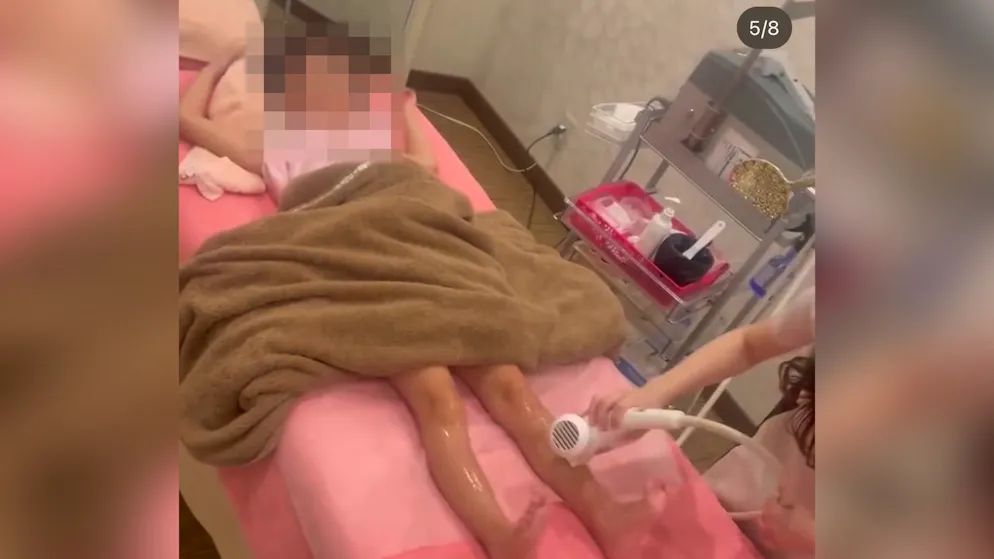 Screenshot aus einem Instagram-Video des Haarentfernungsstudios Dione. Hier werden einem Mädchen gerade die Haare an den Beinen permanent entfernt.