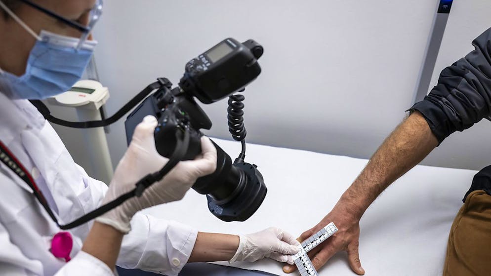 Les infirmières de la nouvelle consultation médico-légale pour adultes victimes de violences (CMLV) des HUG sont notamment  formées pour photographier les lésions des victimes.