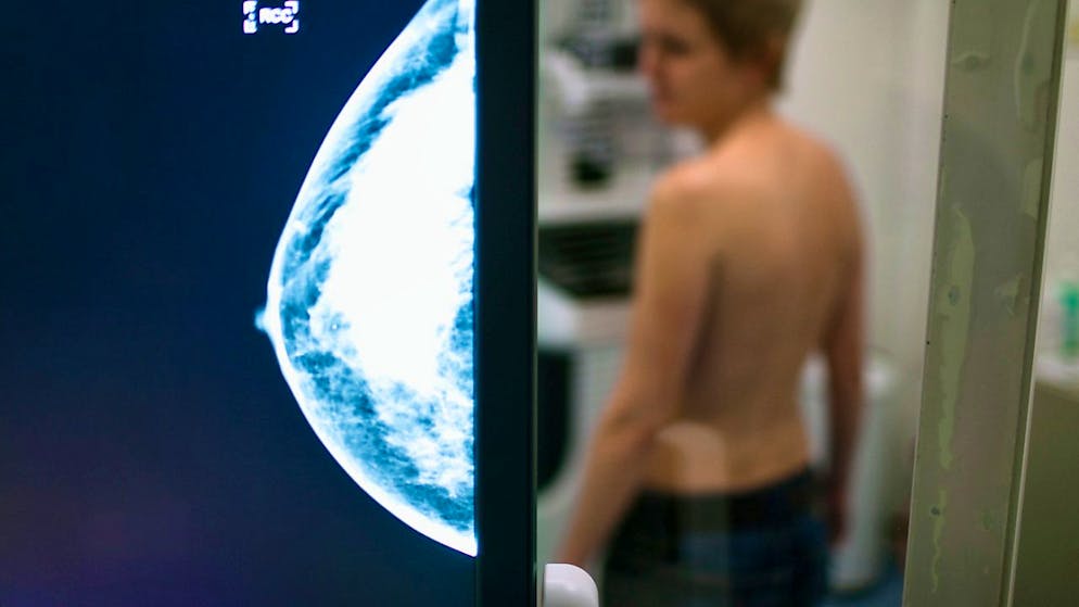 Sobald ein Tumor Metastasen bildet, sinken die Überlebenschancen drastisch.