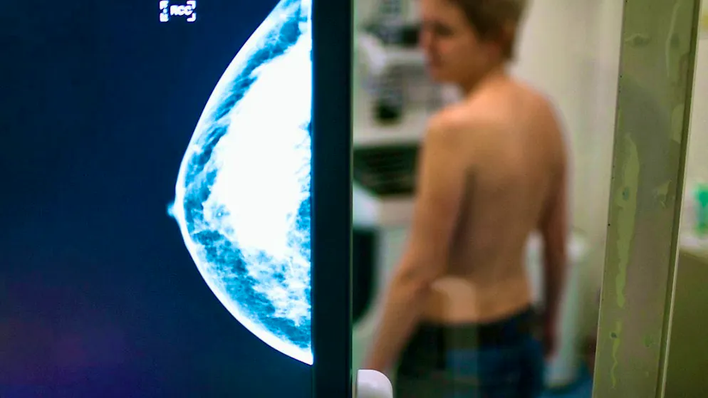 As soon as a tumor forms metastases, the chances of survival drop drastically.