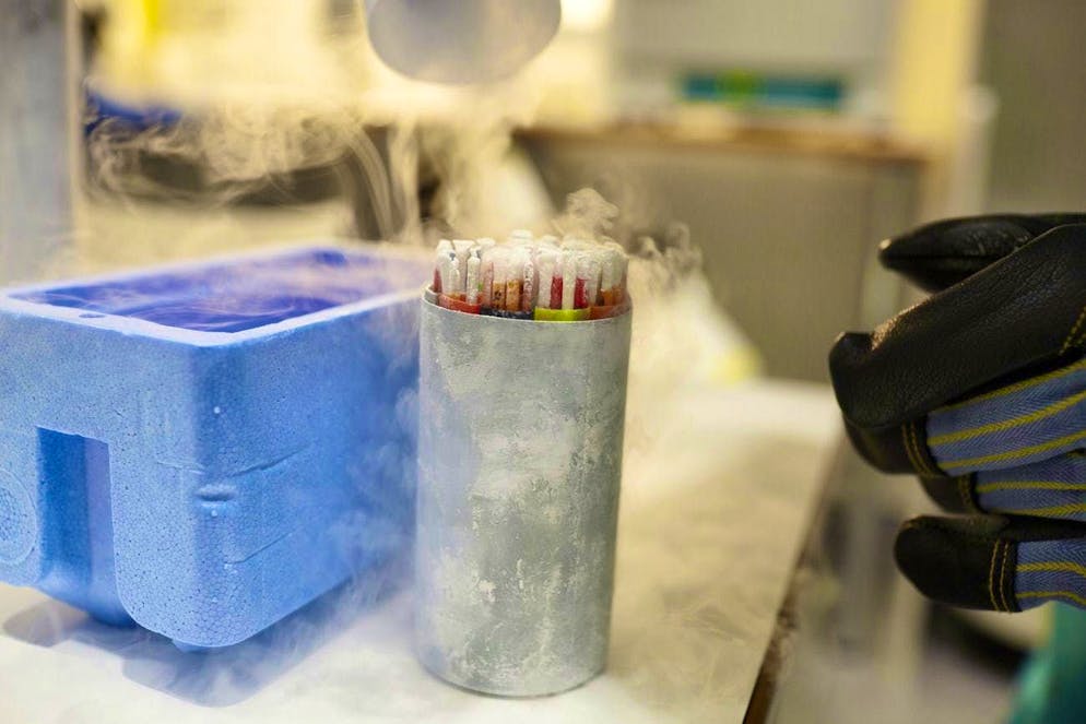 Egg and sperm cells for everyone: fertilized eggs in a laboratory in Zurich (archive photo).