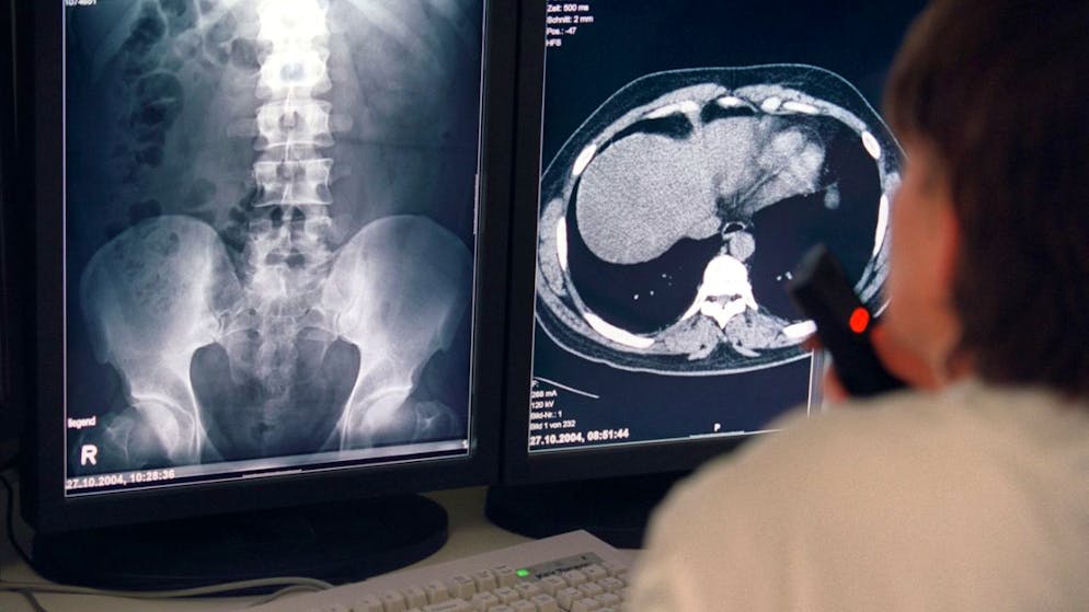 I risultati dello studio mostrano che l'uso dell'intelligenza artificiale non presenta ancora vantaggi tangibili nell'ambito delle diagnosi nella medicina d'urgenza. (Foto simbolica)