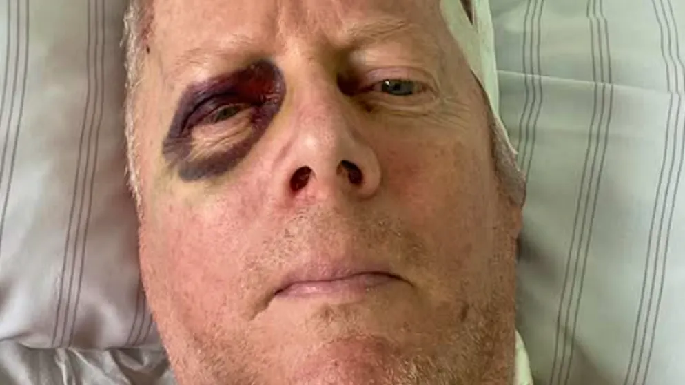 John Doyle in hospital. Comedian falls down stairs - and injures himself seriously