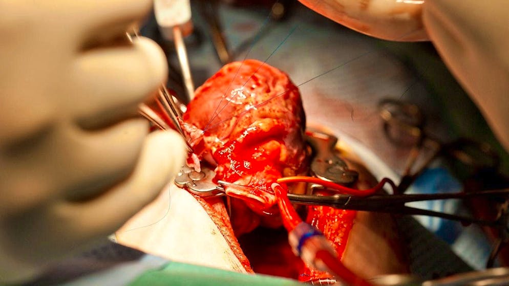 Swiss doctors have kept a heart alive for 12 hours before a transplant. (archive picture)
