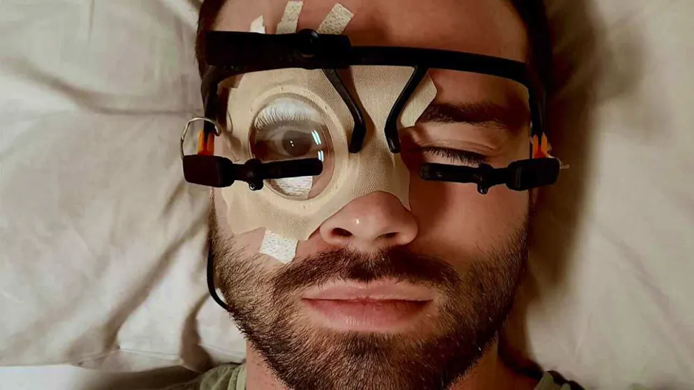 Um die Pupillen während des Schlafes zu beobachten, haben die Forschenden ein Auge mit einer speziellen Klebetechnik offengehalten.
