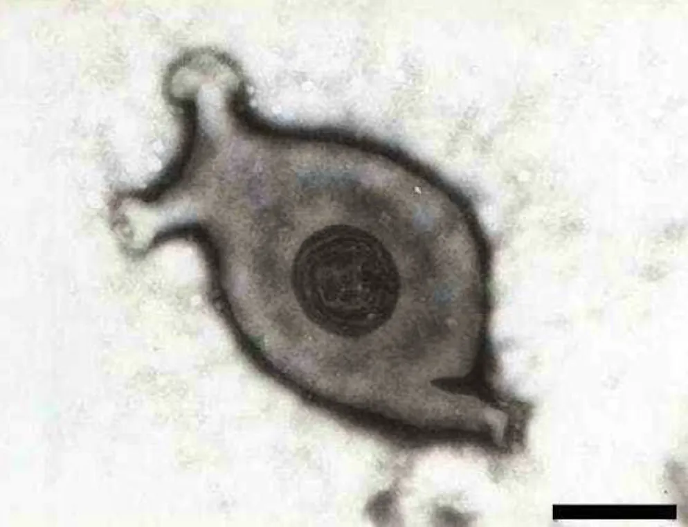 Mycoplasma under the microscope. 