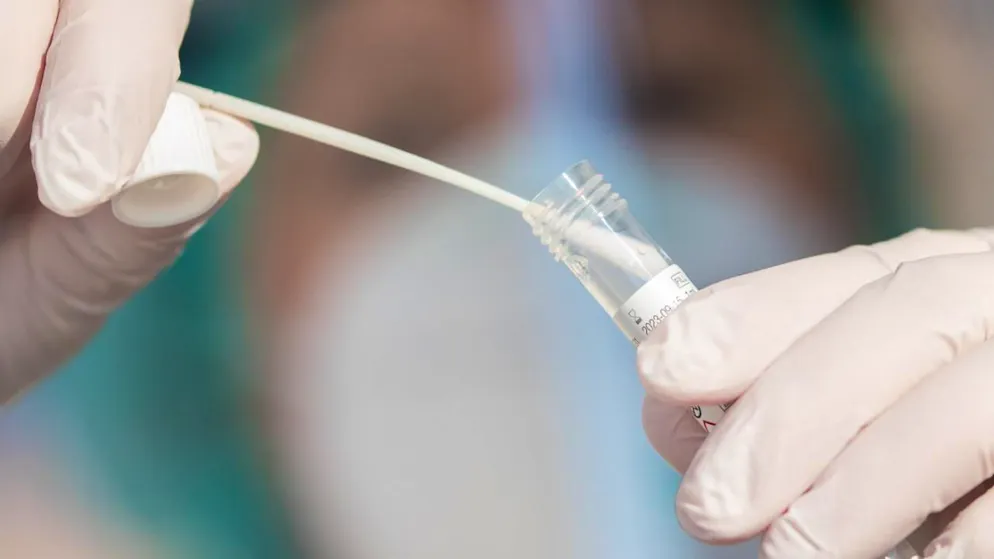 ARCHIV - ILLUSTRATION - Ein Mitarbeiter eines Corona-Testzentrums zeigt einen Abstrich. Foto: Tom Weller/dpa